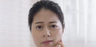 Wajah Melorot Bisa Jadi Bell’s Palsy, Ini Penyebab dan Gejalanya