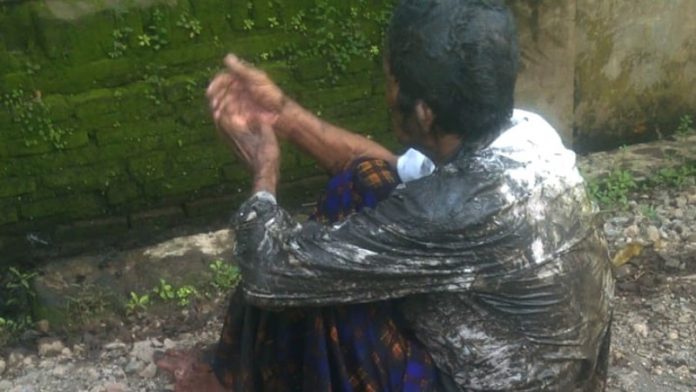 Duladim (60), Warga Desa Pandanrejo, Kecamatan Rejoso, Kabupaten Pasuruan, seperti menahan sakit setelah terjatuh ke dalam got. Ia terjatuh usai berpapasan dengan kendaraan lain, ketika melintasi jalan turunan tajam overpass di Sadengrejo, Rejoso.